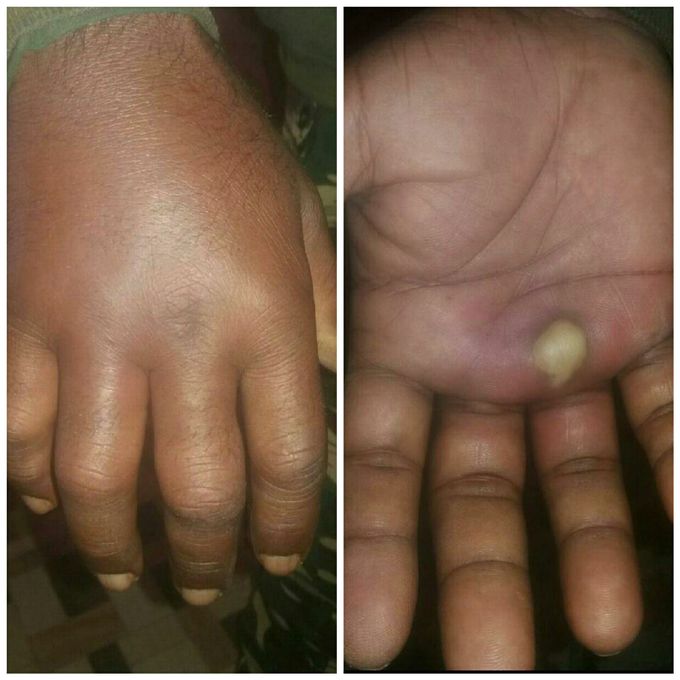 Diagnosis??