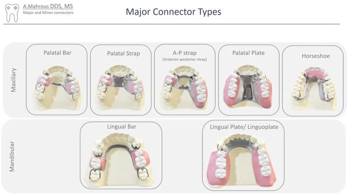 Types of major connector