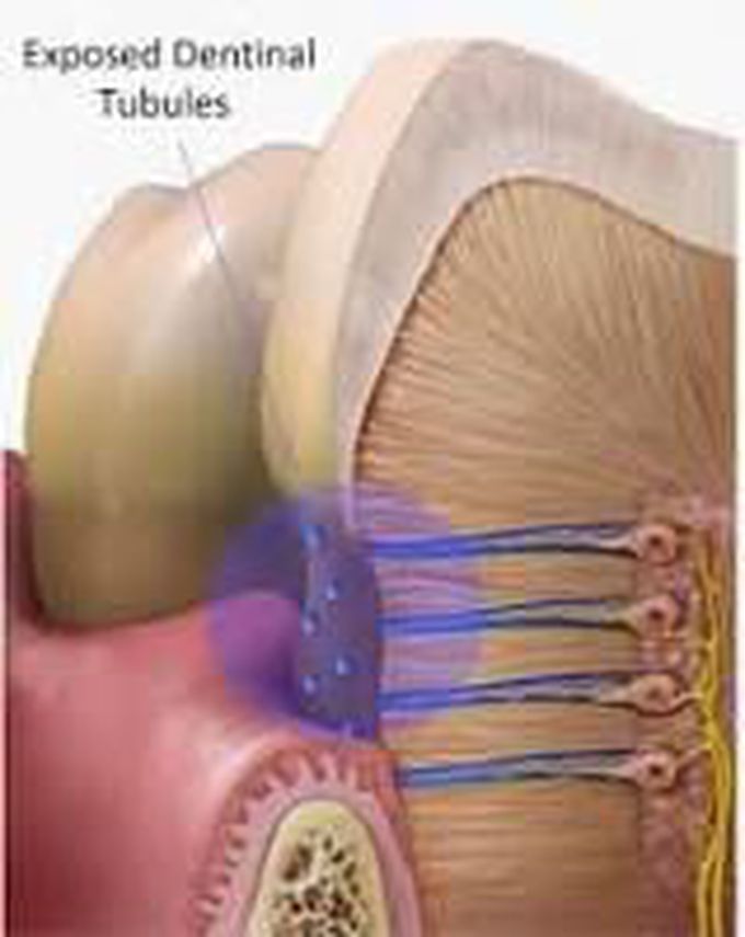 Dentinal tubules