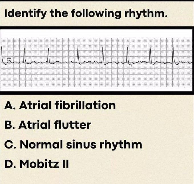 Identify the Rhythm