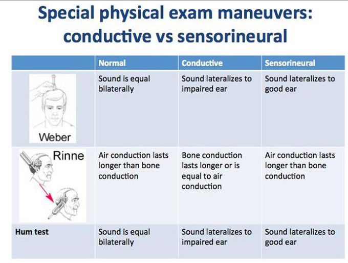 Conduction vs Sensorineural Hearing Loss