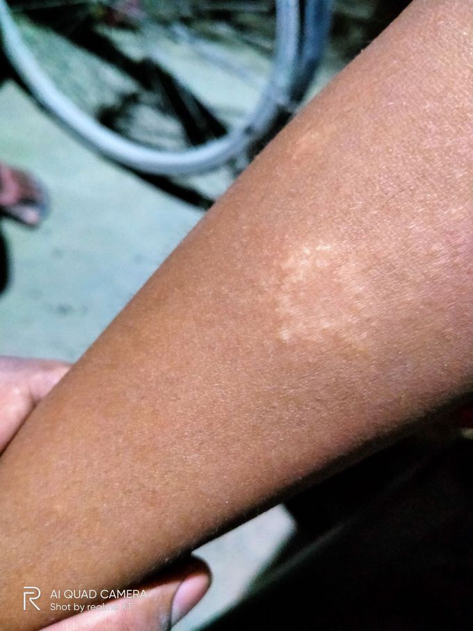 Pain and tenderness. No itching  last 2year please Dignosis and medicine