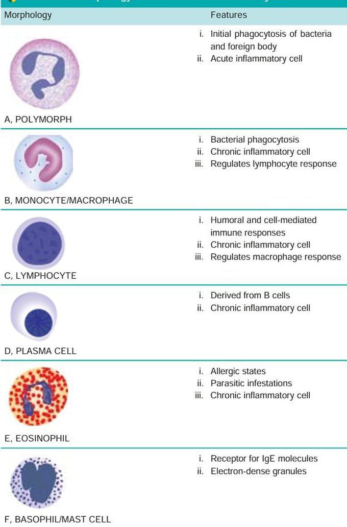 Inflammatory Cells.