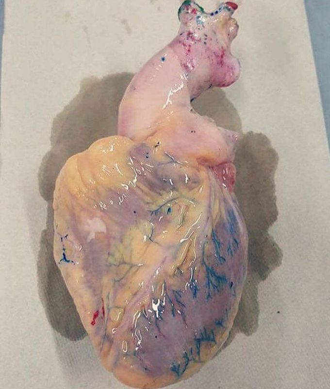 The heart 