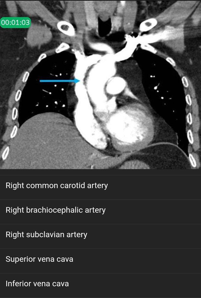 Anatomical quiz