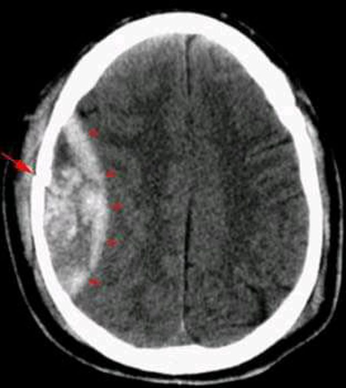 What is your diagnosis?