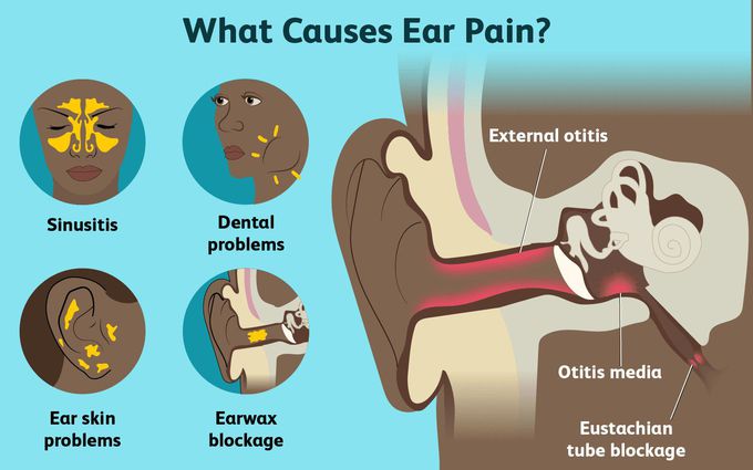 Cause of Earache