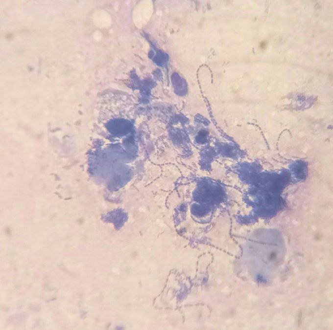 Streptococcus