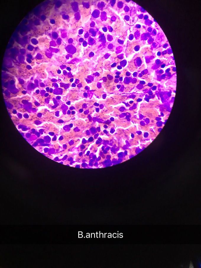 Bacillus anthracis