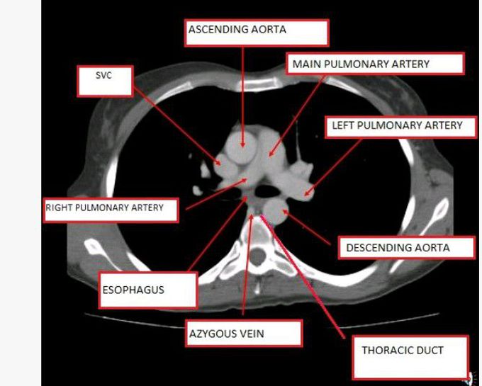 Learn CT diagnosis