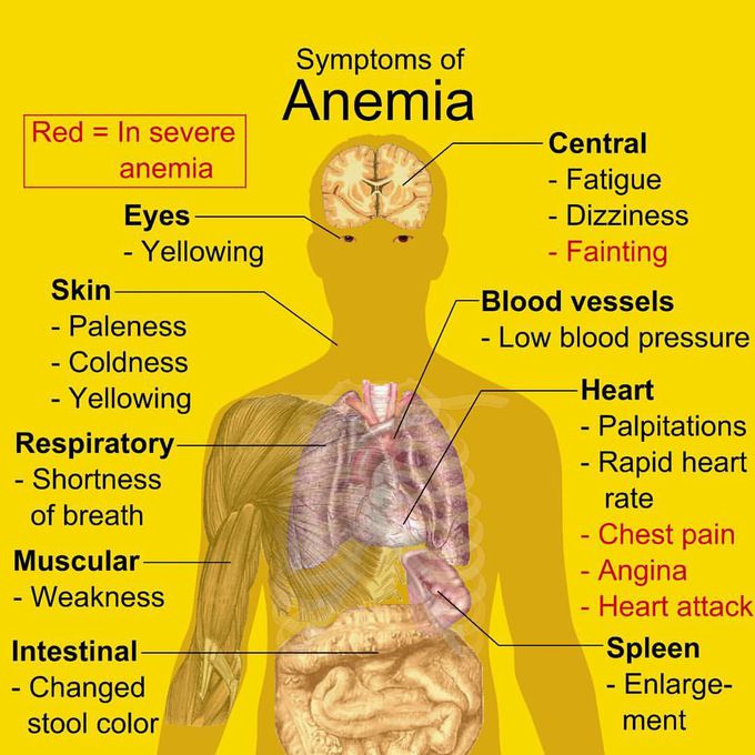 Symptoms Of Anemia
