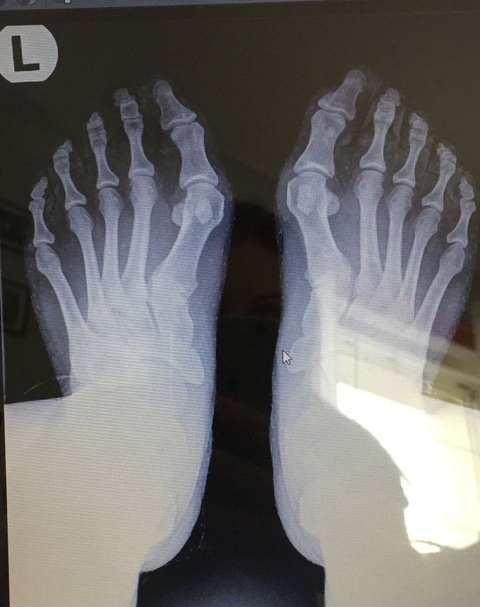 Diagnosis?