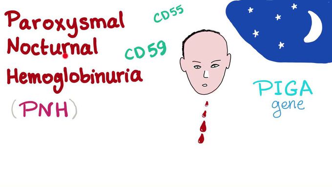 Introduction to the pathology of Paroxysmal Nocturnal Hemoglobinuria (PNH)