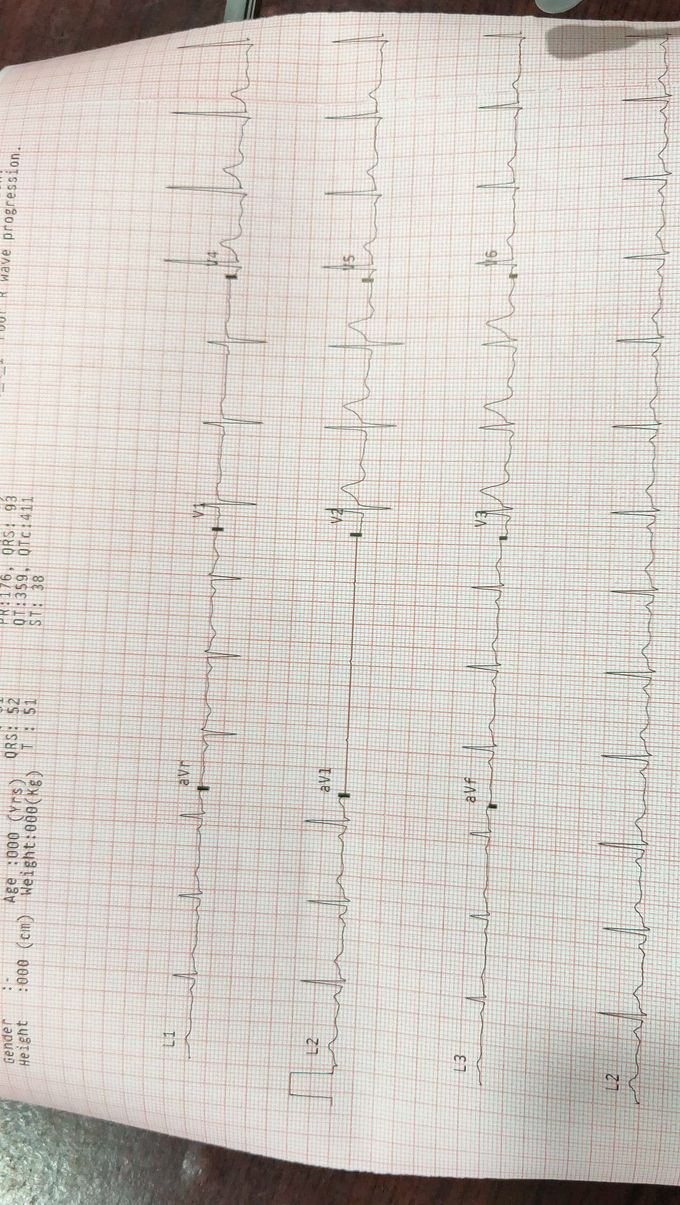 C/o chest discomfort,