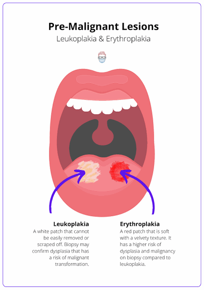 Premalignant Lesions