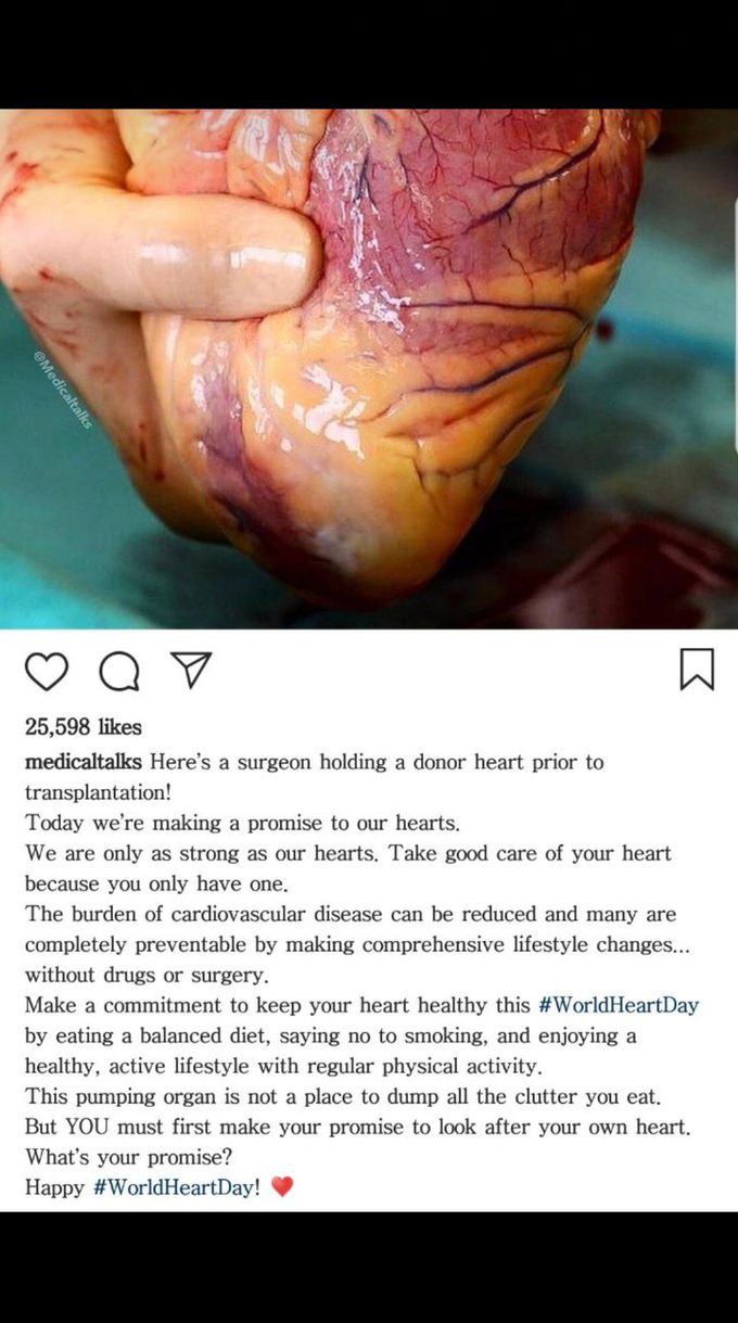 World Heart Day