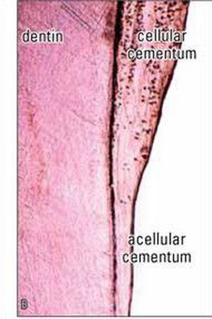 Cellular cementum