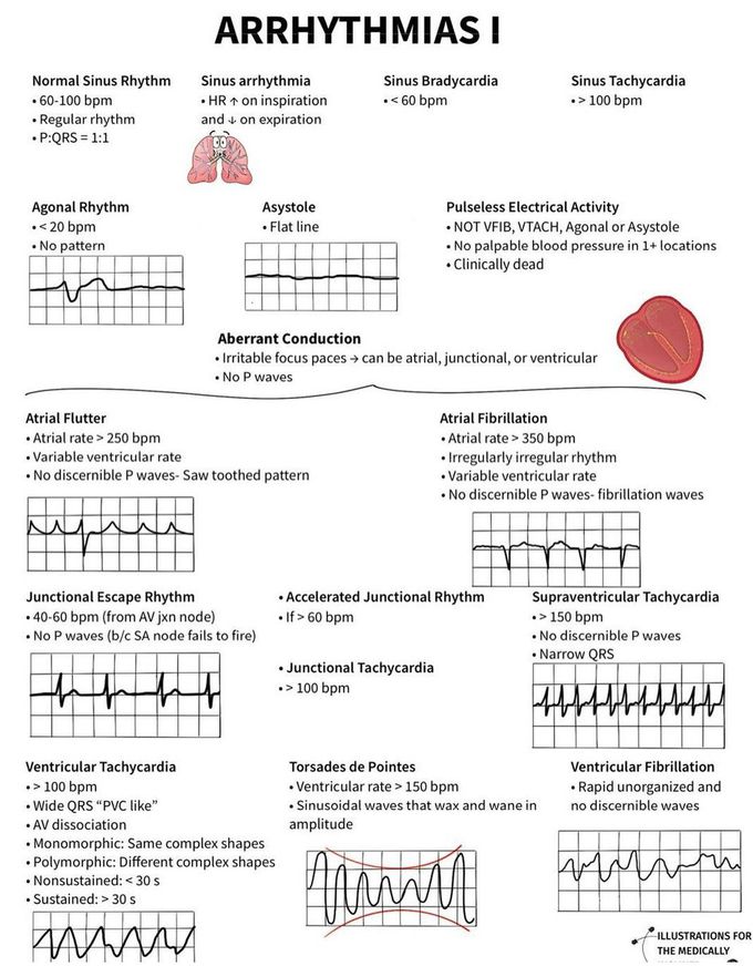 Arrhythmias I