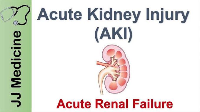 Causes of Acute Kidney injury