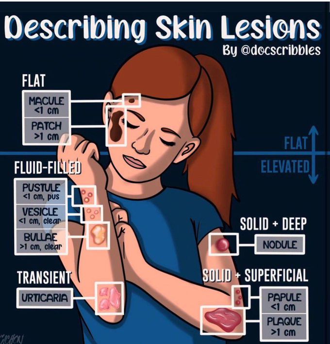 Describing Skin Lesions