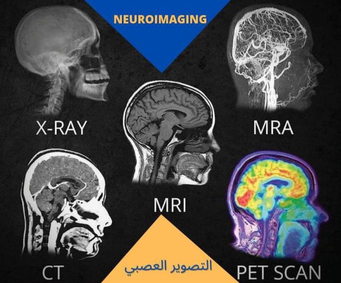 Types of neuroimaging:/