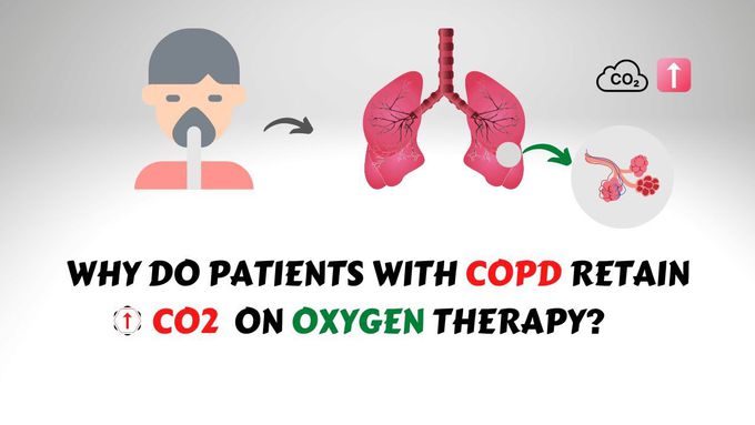 Oxygen Induced CO2 Narcosis in COPD Patients