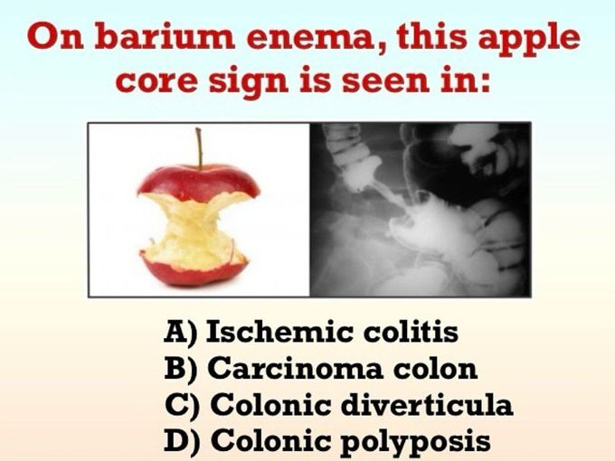 Apple Core Sign