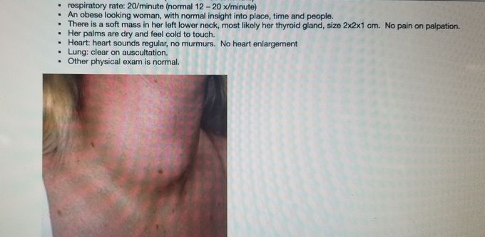 Enlarged Thyroid Gland