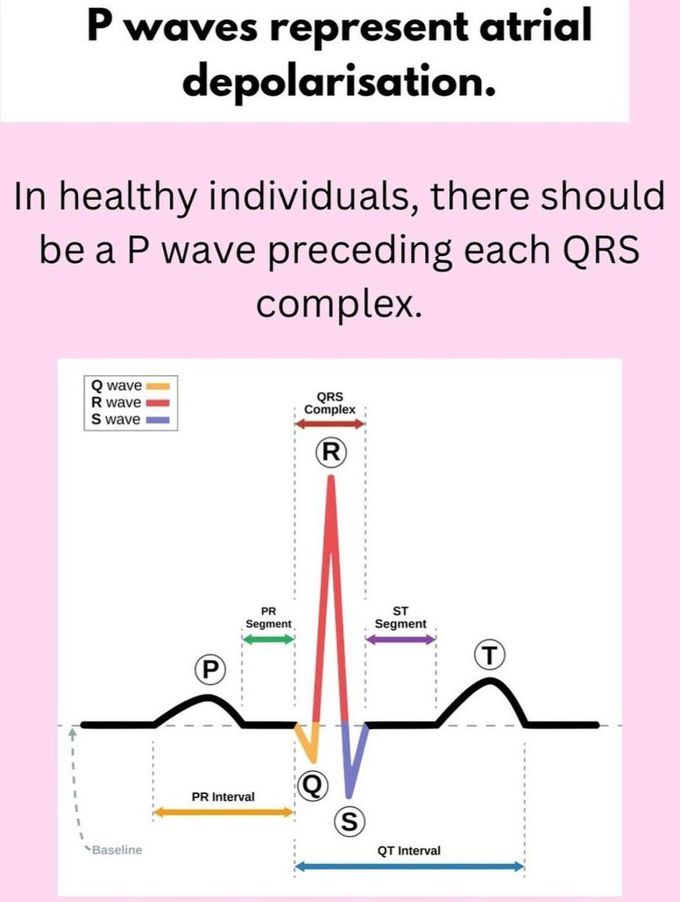 ECG Basics I