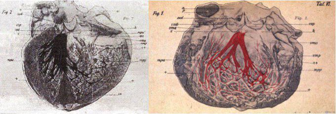 Bifascicular Blocks - What You Need To Know