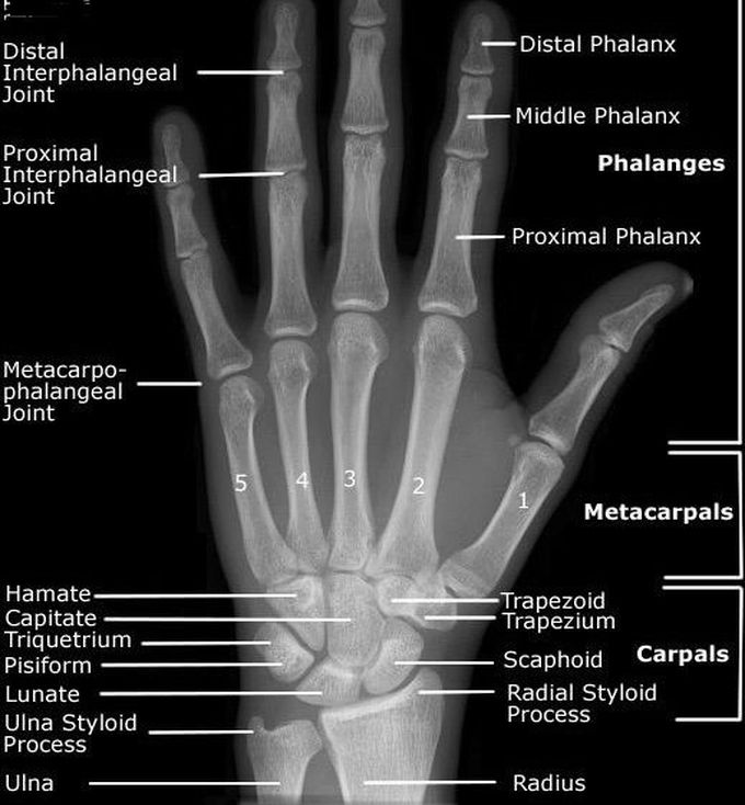 Normal X-ray for hand