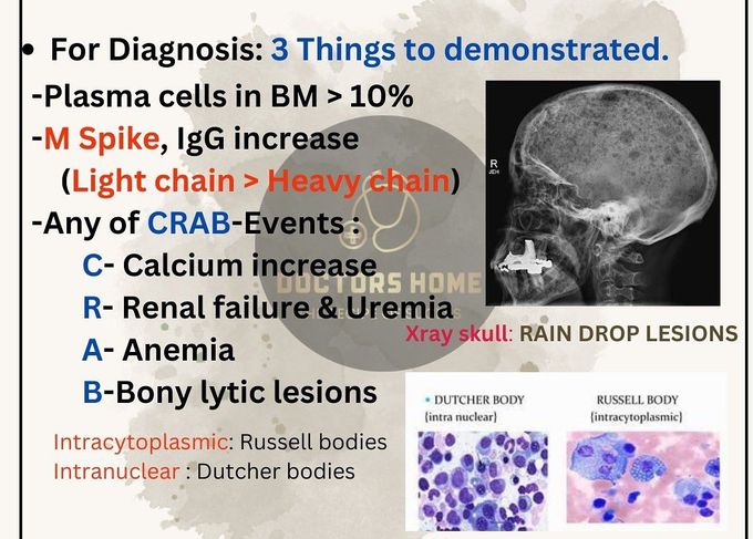 Multiple Myeloma