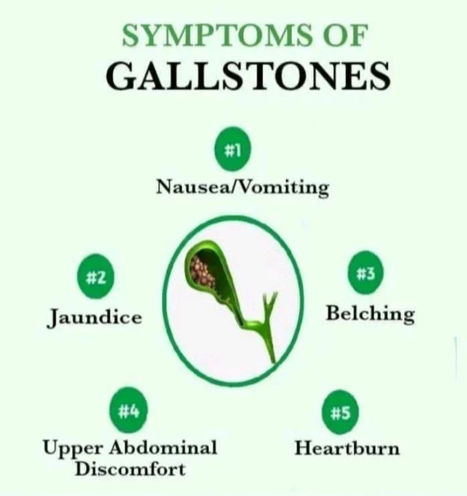 Gallstones - Symptoms