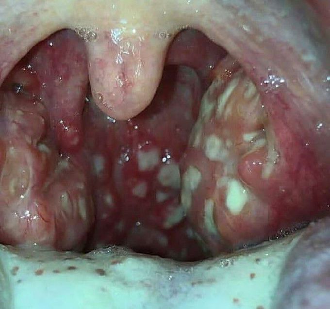 Identify the pathology