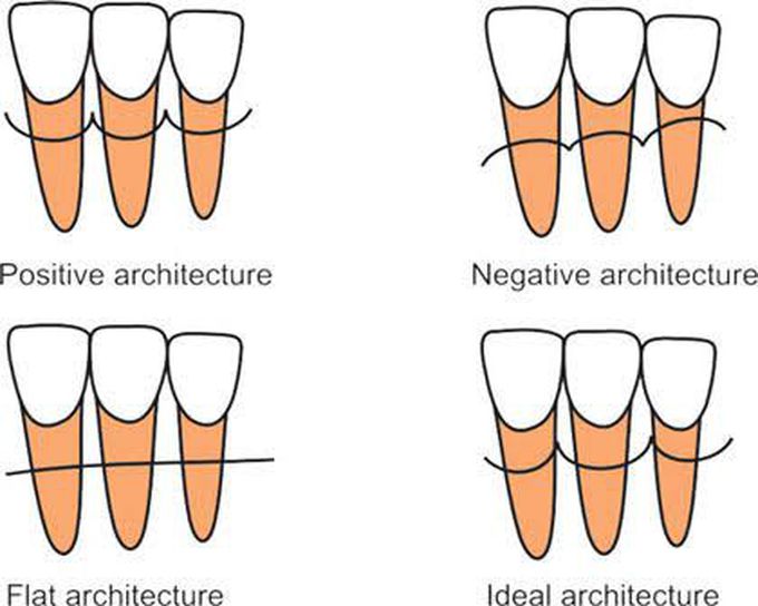 Do you know about positive architecture?