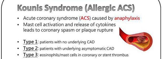 These are the types of Kounis syndrome