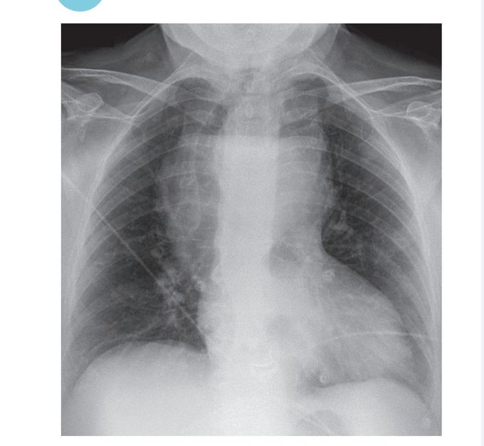 Diagnosis???