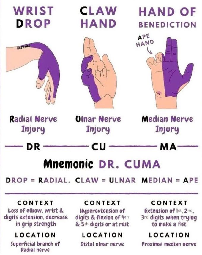 Hand nerve Injuries