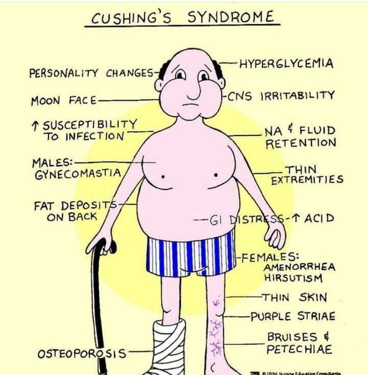 Cushing syndrome - MEDizzy