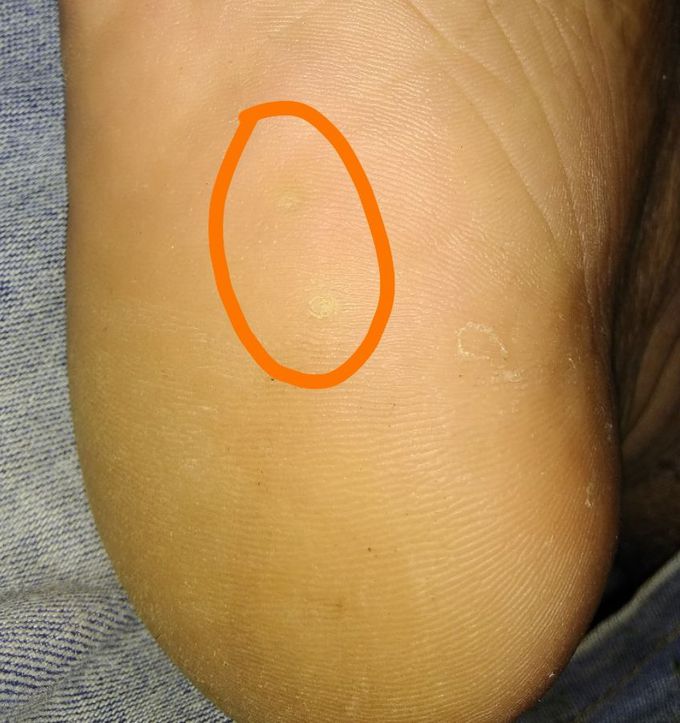Diagnose this condition........,,,,,,?????