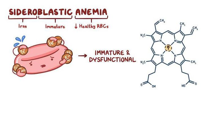 Sideroblastic anemia