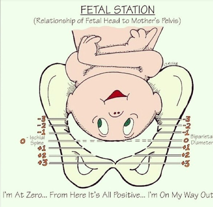 Fetal Stations