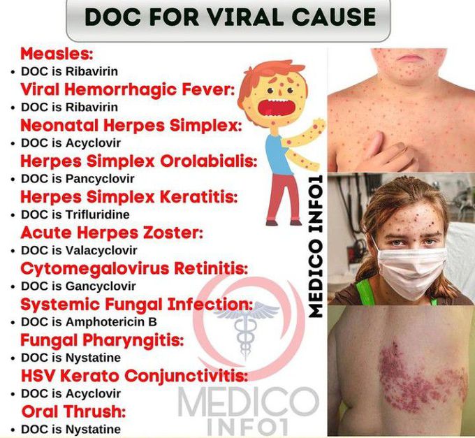 DOC for Viral Infections