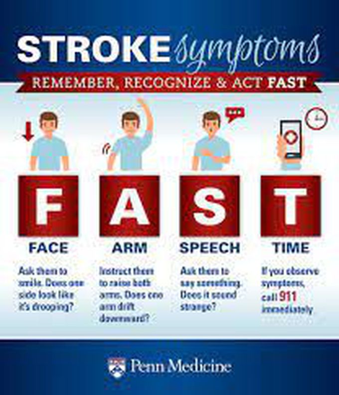 Symptoms of stroke