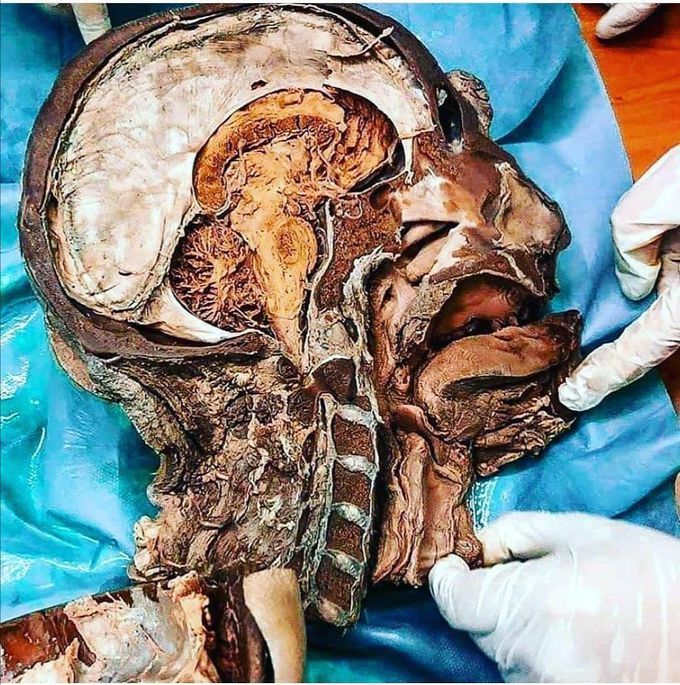 Sagittal section of human Head and Neck.