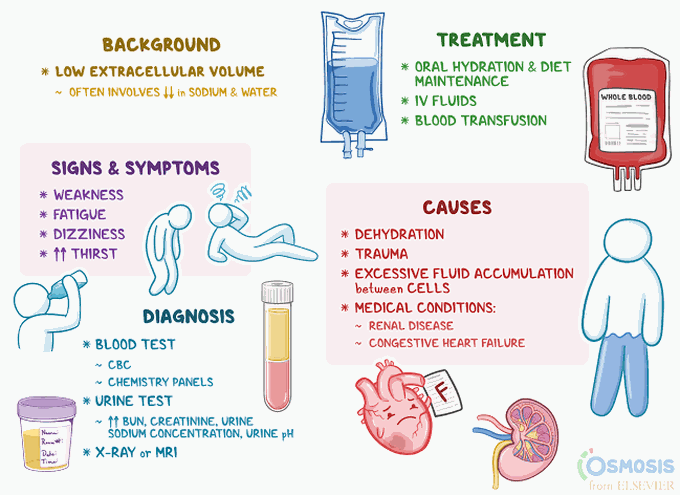 Hypovolemic shock