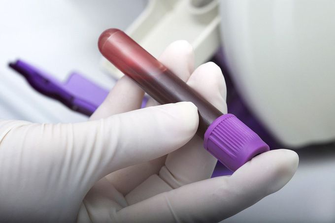 ‘Holy grail’ of blood tests can detect 10 types of cancer