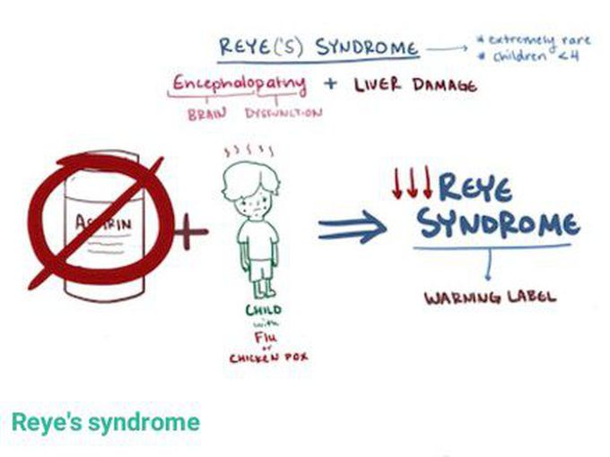 Reye's Syndrome