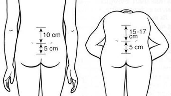 Physical exam : name the test