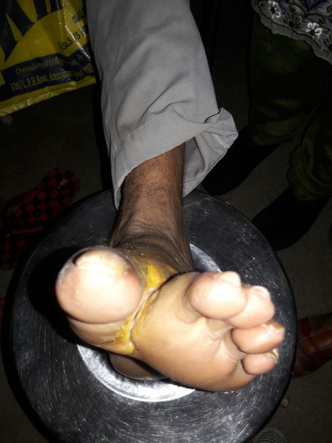 What kind of ulcer is this?